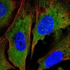 Immunofluorescent staining of human cell line U-2 OS shows localization to cytosol.