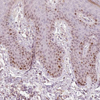 Anti-TREX2 Antibody