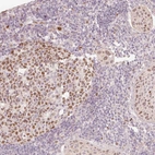 Immunohistochemical staining of human Lymph node shows moderate nuclear positivity in germinal and non-germinal center cells.