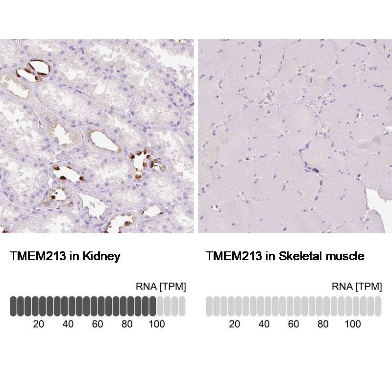 Anti-TMEM213 Antibody