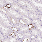 Immunohistochemical staining of human kidney shows strong membranous positivity in cells in tubules.