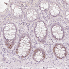 Anti-TREX2 Antibody