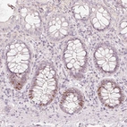 Immunohistochemical staining of human Colon shows moderate nuclear positivity in enteroendocrine cells.