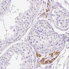 Immunohistochemical staining of human testis shows moderate cytoplasmic positivity in Leydig cells.
