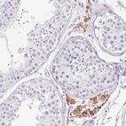 Immunohistochemical staining of human testis shows moderate cytoplasmic positivity in Leydig cells.
