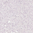 Immunohistochemical staining of human Liver shows no positivity in hepatocytes as expected.