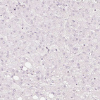 Anti-TREX2 Antibody