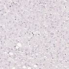 Immunohistochemical staining of human Liver shows no positivity in hepatocytes as expected.