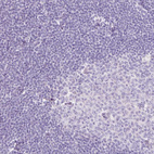 Anti-TMEM213 Antibody