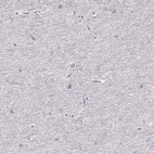 Immunohistochemical staining of human cerebral cortex shows no positivity in neurons as expected.