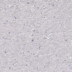Immunohistochemical staining of human cerebral cortex shows no positivity in neurons as expected.