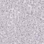 Anti-ZP3 Antibody