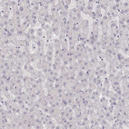 Immunohistochemical staining of human liver shows no positivity in hepatocytes as expected.