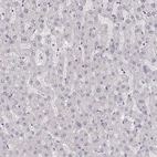 Immunohistochemical staining of human liver shows no positivity in hepatocytes as expected.