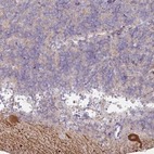 Anti-MTMR14 Antibody