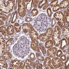 Immunohistochemical staining of human kidney shows strong cytoplasmic granular positivity in cells in tubules.