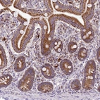 Immunohistochemical staining of human duodenum shows strong cytoplasmic granular positivity in glandular cells.