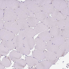 Immunohistochemical staining of human skeletal muscle shows no positivity in myocytes as expected.