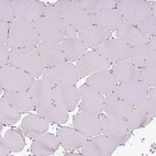 Immunohistochemical staining of human skeletal muscle shows no positivity in myocytes as expected.