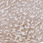 Immunohistochemical staining of human liver shows moderate cytoplasmic positivity in hepatocytes.