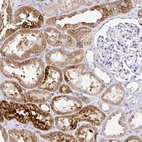 Immunohistochemical staining of human kidney shows strong cytoplasmic positivity in cells in tubules.