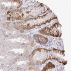 Immunohistochemical staining of human stomach shows strong cytoplasmic positivity in glandular cells.