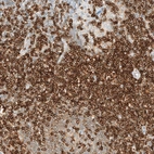 Immunohistochemical staining of human lymph node shows strong membranous positivity in germinal and non-germinal center cells.