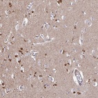 Anti-PRR5 Antibody