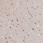Anti-NEIL1 Antibody