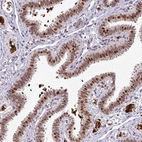 Immunohistochemical staining of human fallopian tube shows strong nuclear positivity in glandular cells.