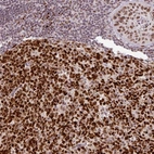 Immunohistochemical staining of human lymphoid tissues shows strong nuclear positivity in germinal center cells.