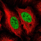 Immunofluorescent staining of human cell line HeLa shows localization to nucleoplasm.
