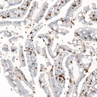 Immunohistochemical staining of human small intestine shows strong membranous positivity in lymphoid cells.