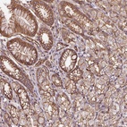 Anti-B3GALT5 Antibody