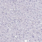 Immunohistochemical staining of human liver shows low expression as expected.