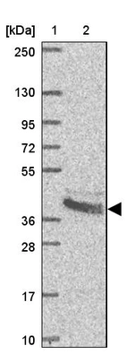 Lane 1: Marker [kDa] 250, 130, 95, 72, 55, 36, 28, 17, 10_br/_Lane 2: Human cell line RT-4