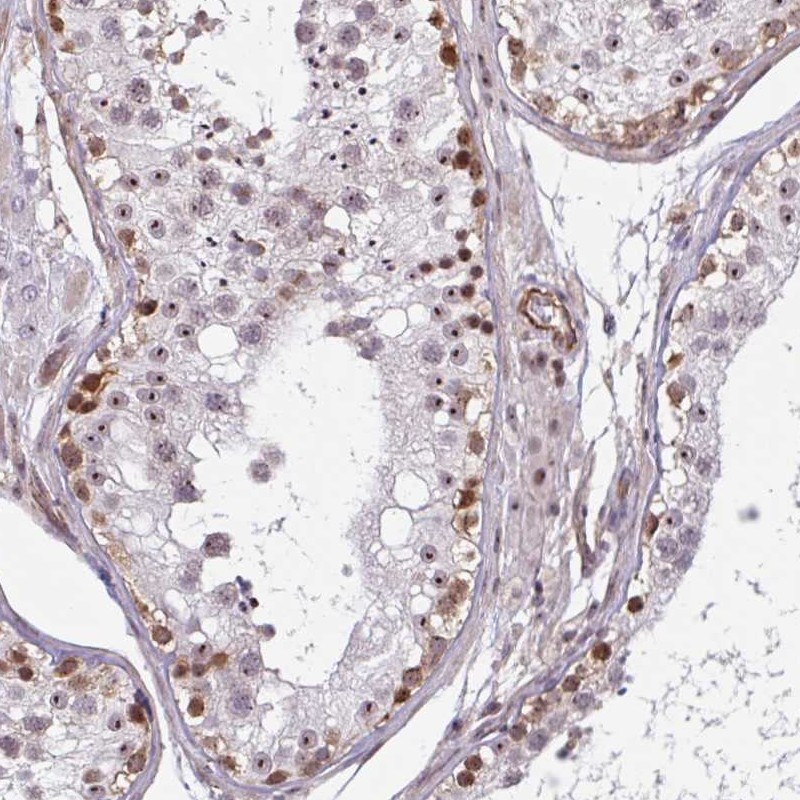 Anti-ZNF689 Antibody