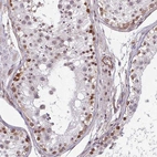 Anti-ZNF689 Antibody