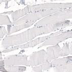 Immunohistochemical staining of human skeletal muscle shows no positivity in myocytes as expected.