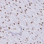 Immunohistochemical staining of human heart muscle shows strong nuclear positivity in cardiomyocytes.