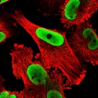 Immunofluorescent staining of human cell line U-251 MG shows localization to nucleoplasm.