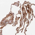 Anti-MFAP4 Antibody