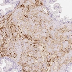 Immunohistochemical staining of human prostate shows moderate extracellular space positivity in smooth muscle cells.