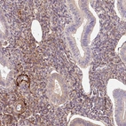 Immunohistochemical staining of human endometrium shows moderate extracellular space positivity in stromal cells.