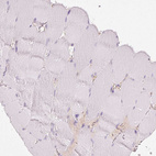 Immunohistochemical staining of human skeletal muscle shows no positivity in myocytes as expected.