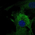Immunofluorescent staining of human cell line BJ shows localization to endoplasmic reticulum.