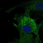 Immunofluorescent staining of human cell line BJ shows localization to endoplasmic reticulum.