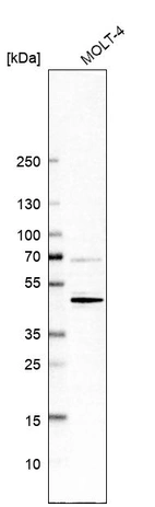 Western blot analysis in human cell line MOLT-4.