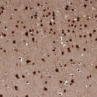 Anti-MORF4L2 Antibody