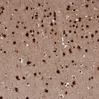 Anti-MORF4L2 Antibody